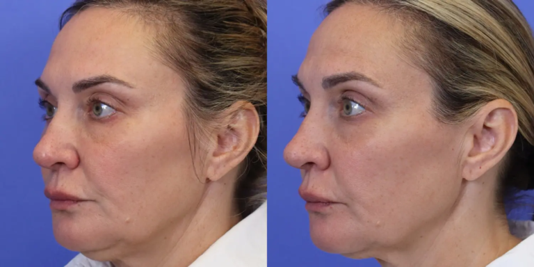 1123 New-5-29-EmFace B&A7