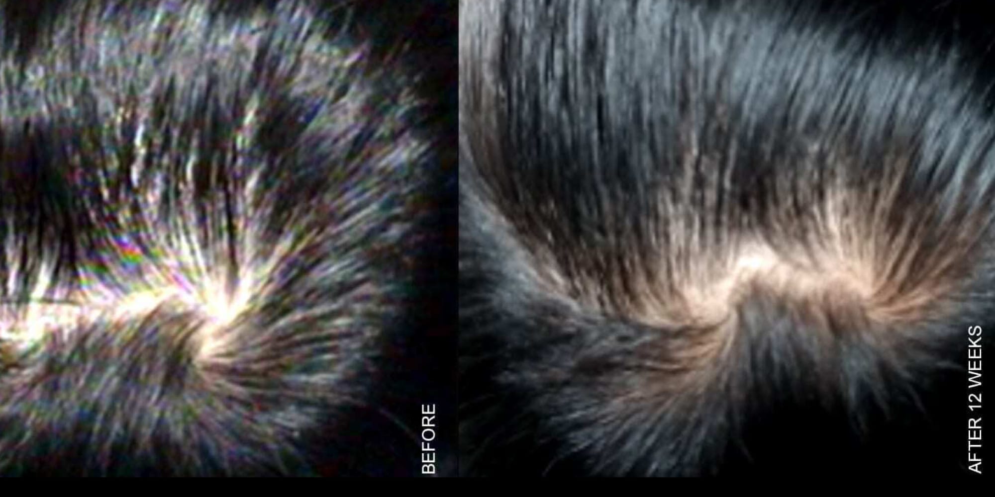 hair loss before and after the hughes center
